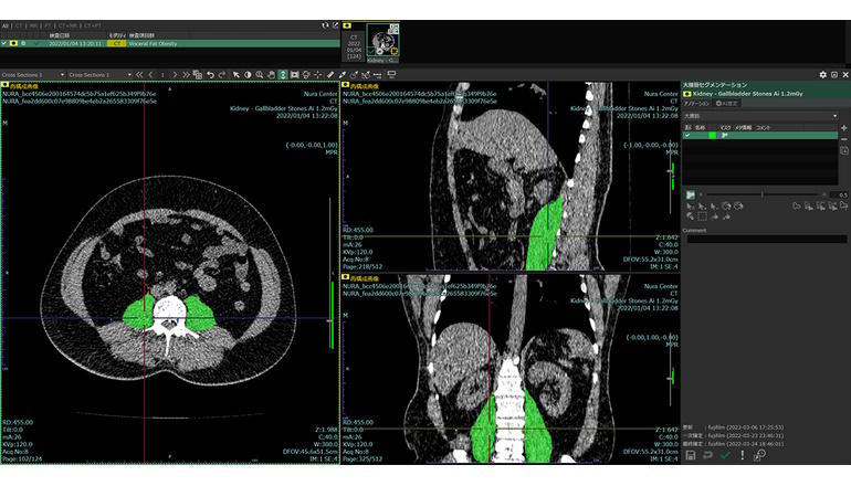 高度な診断技術の研究開発を支援する、医用画像DBをクラウドで運用